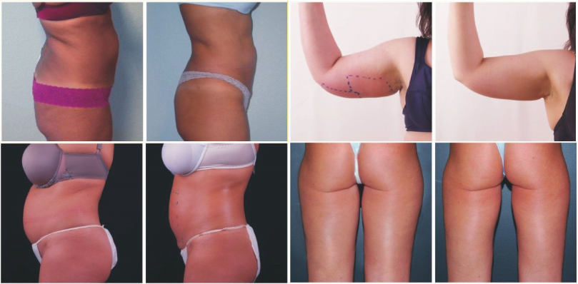 You must want to loss weight and reduce the cellulite.WATCH HERE!!!!!