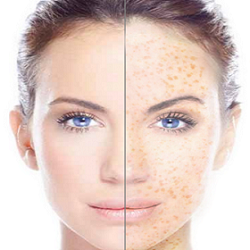 Everything you need to know about Pigmentation！！！！